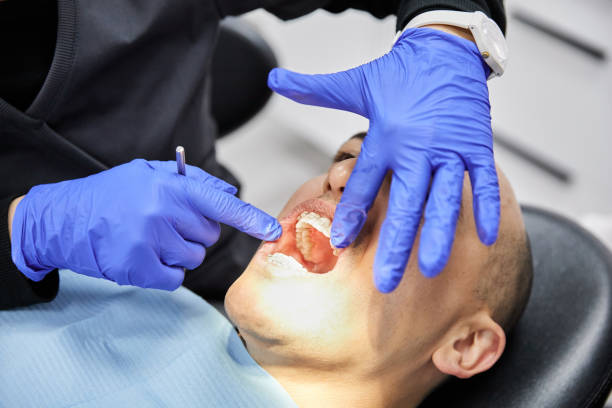 Best Dental Abscess Treatment in Macon, MO
